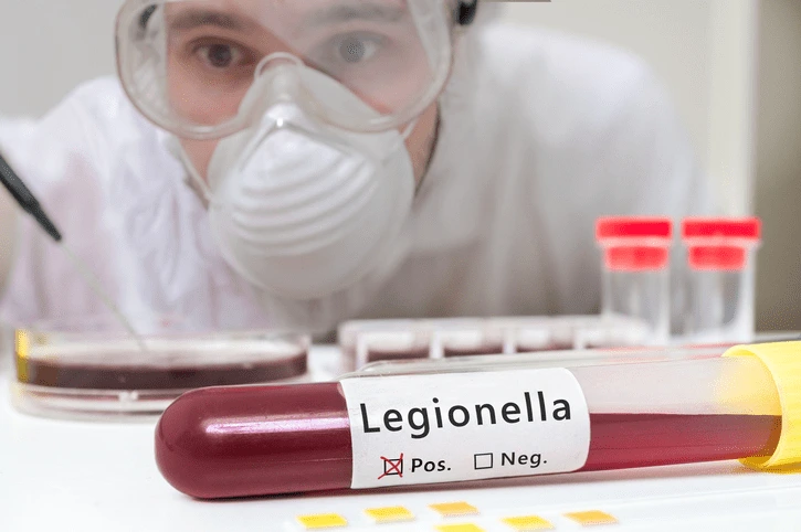 Legionella Jobs - Future Select